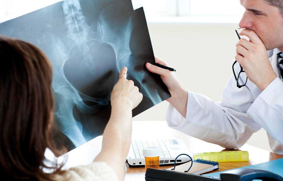 médecins examinant des radiographies pour l'arthrose de la hanche