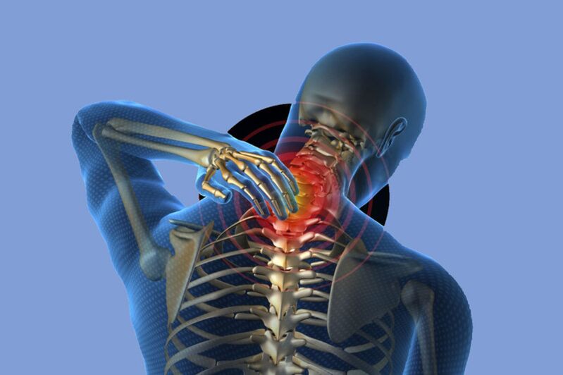 Douleur au cou dans l'ostéochondrose